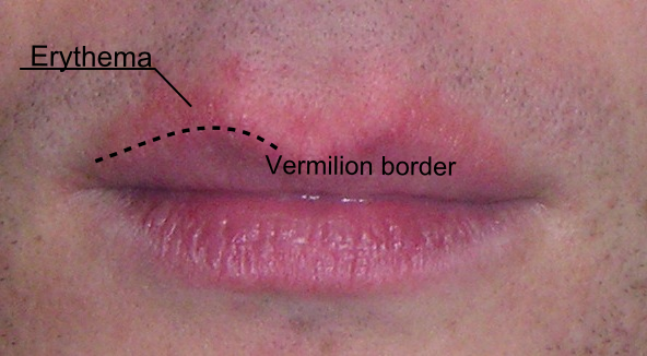  Vermilion Border